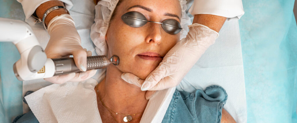 What To Know About Laser Treatments For Skin