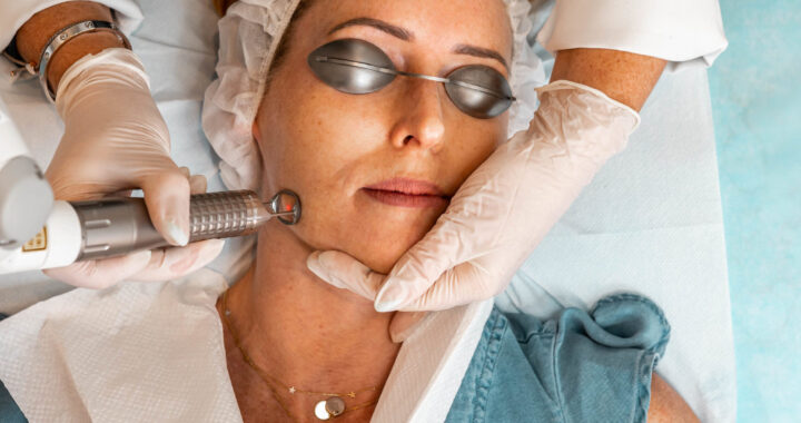 What To Know About Laser Treatments For Skin