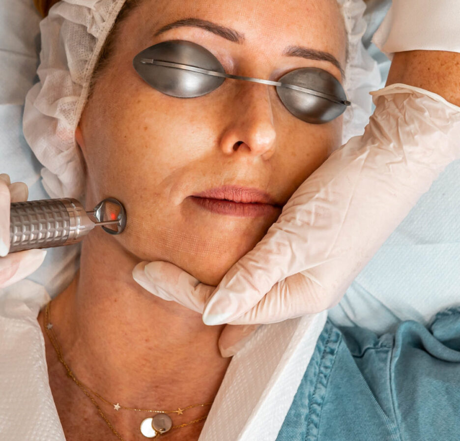 What To Know About Laser Treatments For Skin